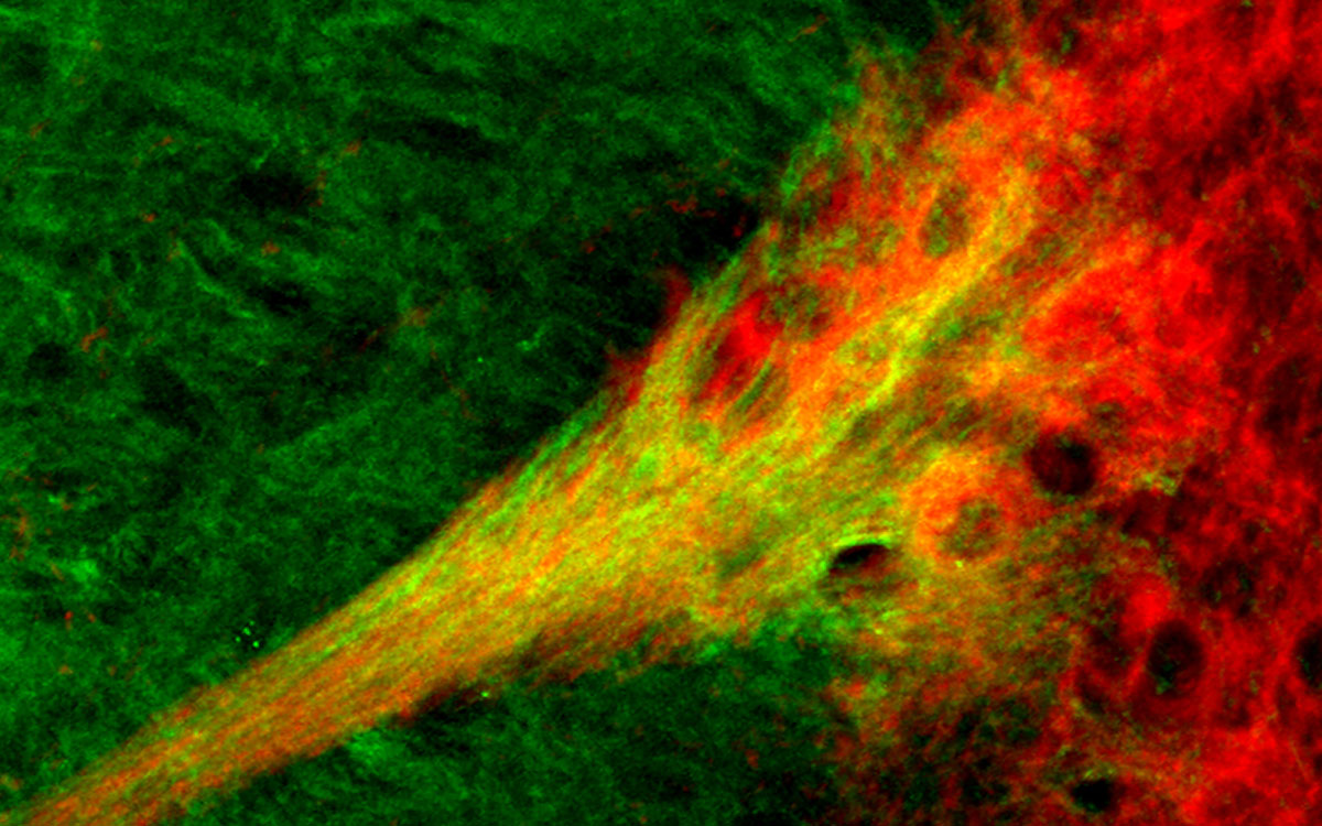 Substantia nigra - striatal circuit