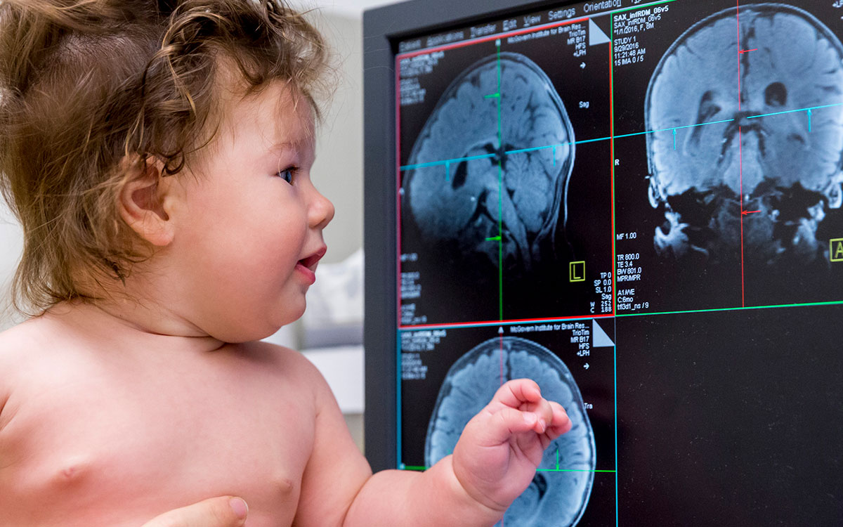 Baby looks at brain image