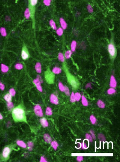 Image of green and magenta cells under a microscope. 