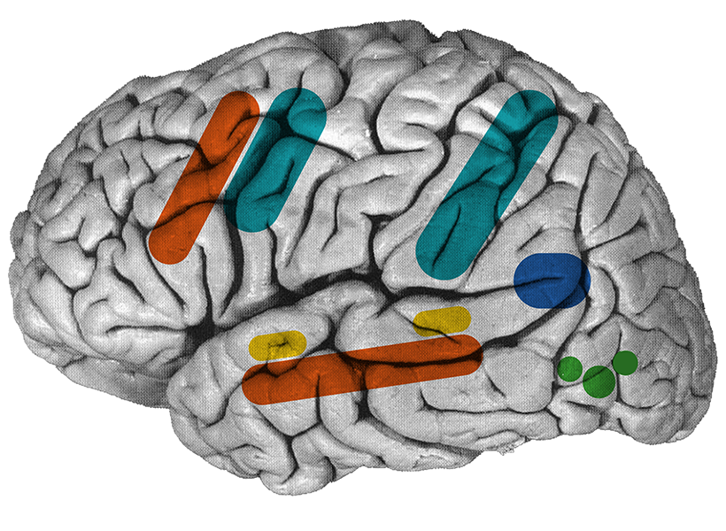 Brain with colored blobs.