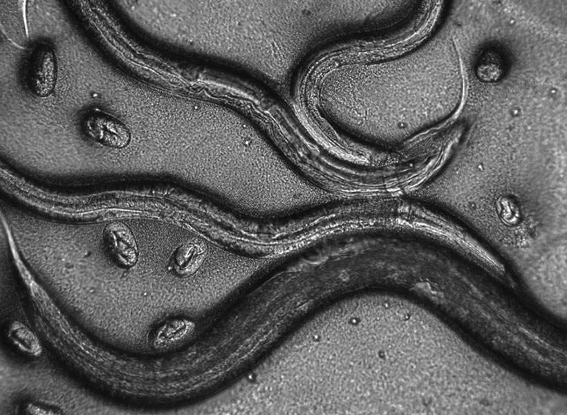 black and white microscopic image of worms