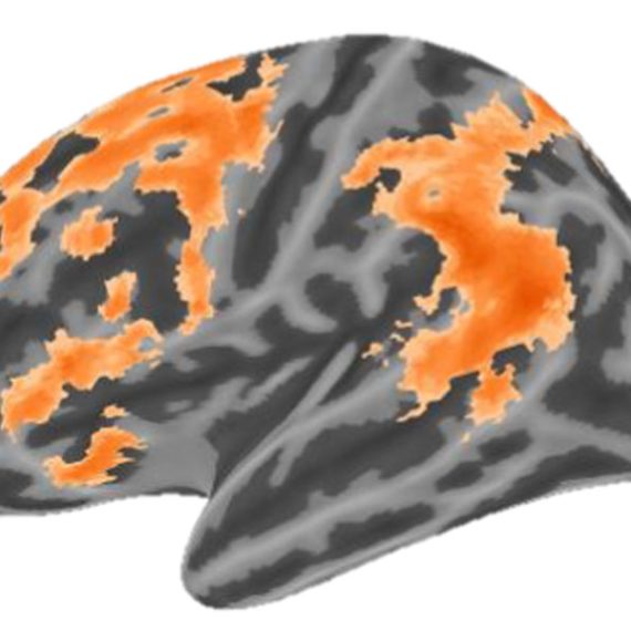 Computer generated image of brain with orange regions indicating activity.