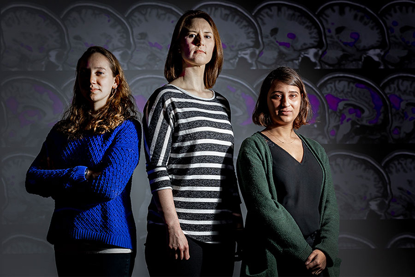 Three women posing for photo with brain images in background.