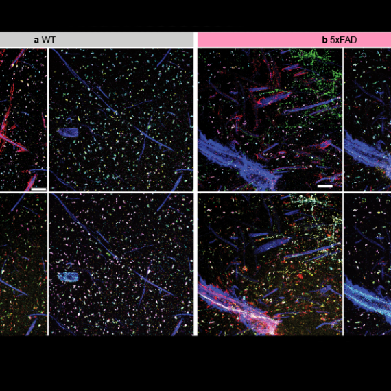 Microscopic image of neurons in a grid of eight squares.